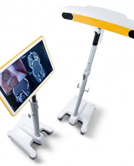 Beyin Cerrahi  NöroNavigasyon